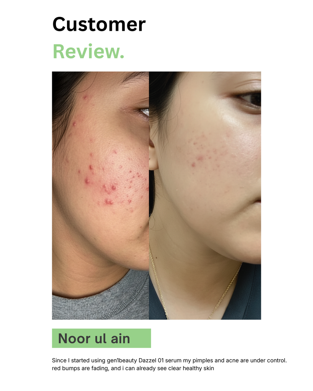 Dazzel-01 Face Serum